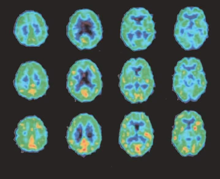 In 30 Tagen aus dem Alkohol: Unser ärztlich begleitetes Coachingprogramm