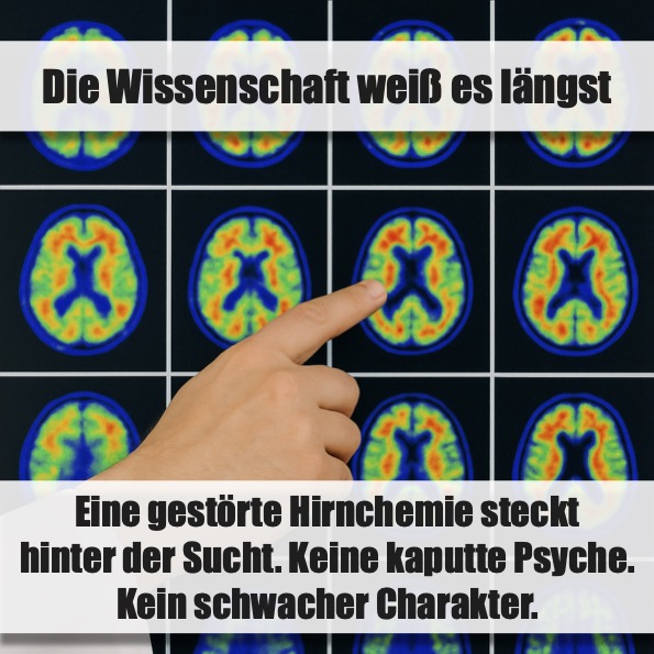 Eine gestörte Hirnchemie zwingt uns, immer wieder zur Flasche zu greifen. Nicht eine ominöse "Psyche".